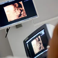 Na ekranie USG 4D widać twarz dziecka. To zdjęcie z ok. 20. tygodnia ciąży, w którym można już dostrzec pleć.