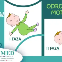 Ilustracja pokazuje dwie fazy odruchu Moro u niemowląt: pierwszą, gdzie dziecko jest w pozycji rozłożonej, i drugą, gdzie płacze.