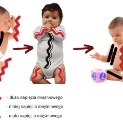 Zmiany w napięciu mięśniowym u niemowląt: od nadmiernego napięcia do swobodniejszych ruchów.
