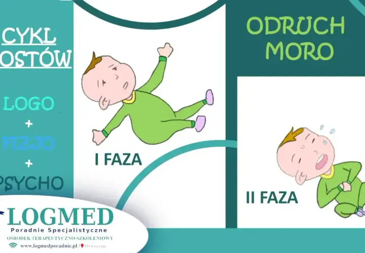 Ilustracja pokazuje dwie fazy odruchu Moro u niemowląt: pierwszą, gdzie dziecko jest w pozycji rozłożonej, i drugą, gdzie płacze.