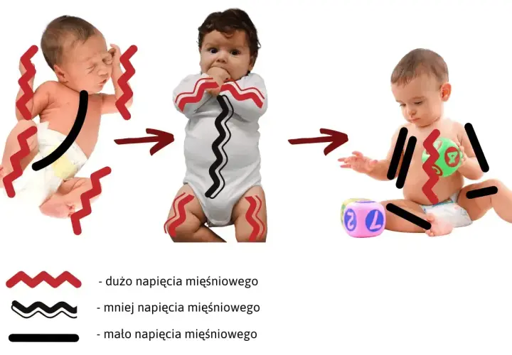 Zmiany w napięciu mięśniowym u niemowląt: od nadmiernego napięcia do swobodniejszych ruchów.
