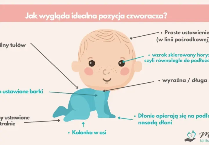Ilustracja pokazuje idealną pozycję, gdy dziecko raczkuje: stabilny tułów, nisko ustawione barki, neutralne stopy, kolanka w osi, prosta głowa, wzrok poziomo i wyraźna szyja.