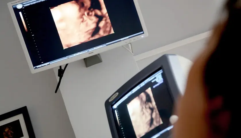 Na ekranie USG 4D widać twarz dziecka. To zdjęcie z ok. 20. tygodnia ciąży, w którym można już dostrzec pleć.