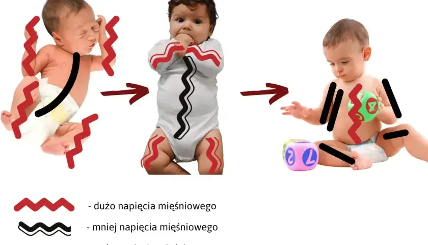 Zmiany w napięciu mięśniowym u niemowląt: od nadmiernego napięcia do swobodniejszych ruchów.