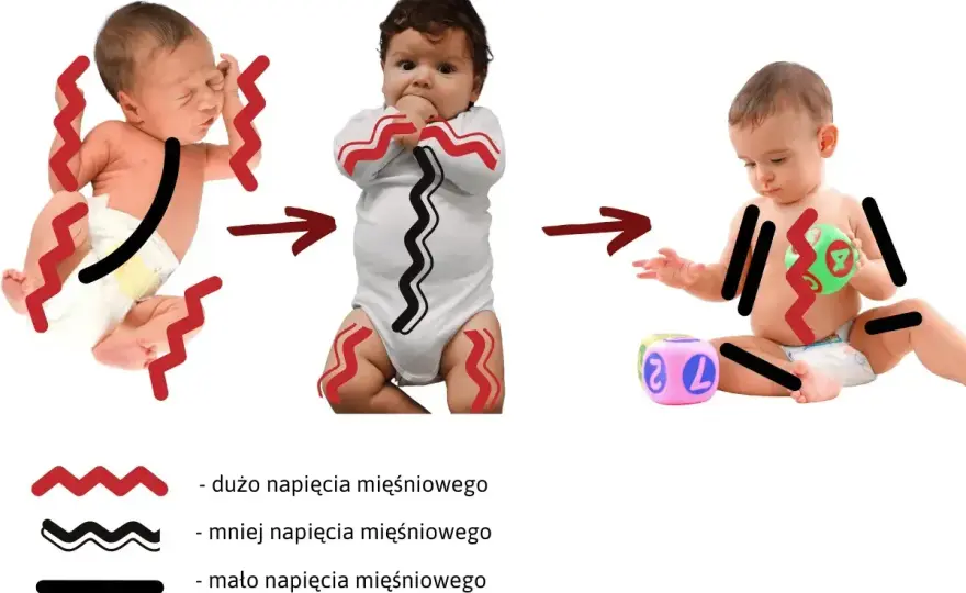 Napięcie mięśniowe u niemowlęcia - kiedy to sygnał alarmowy?