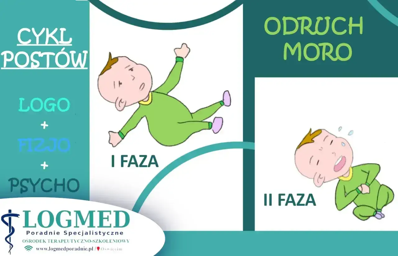 Ilustracja pokazuje dwie fazy odruchu Moro u niemowląt: pierwszą, gdzie dziecko jest w pozycji rozłożonej, i drugą, gdzie płacze.