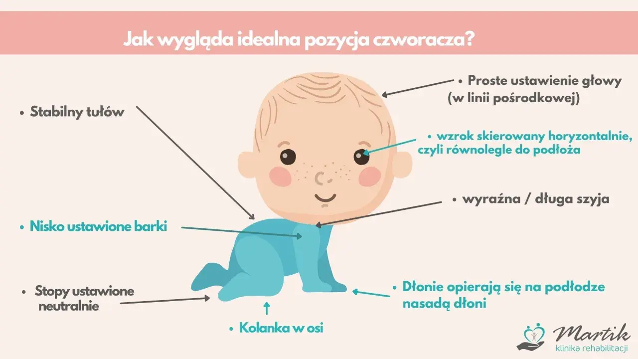 Ilustracja pokazuje idealną pozycję, gdy dziecko raczkuje: stabilny tułów, nisko ustawione barki, neutralne stopy, kolanka w osi, prosta głowa, wzrok poziomo i wyraźna szyja.